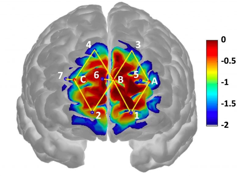 Analyzing Brain Activity to Diagnose and Treat Pain