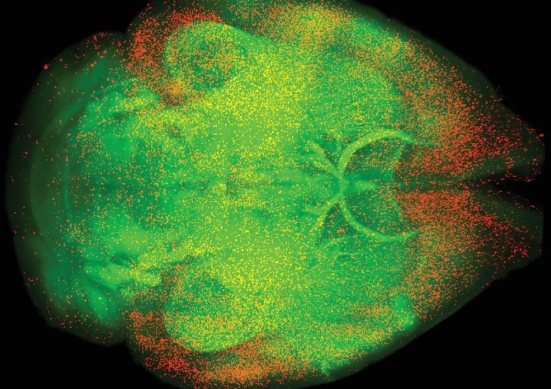 Oxycodone Induced Brain Activity