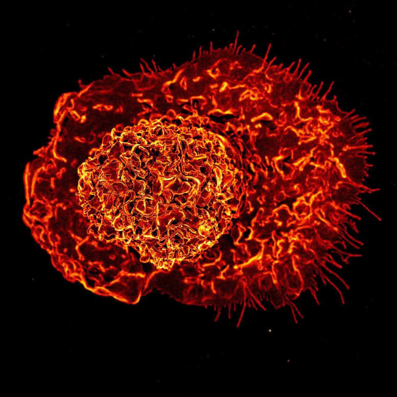 Scanning Electron Micrograph of a Macrophage