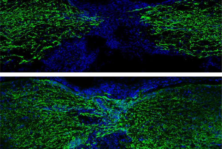 Zebrafish Regrow Spinal Cord